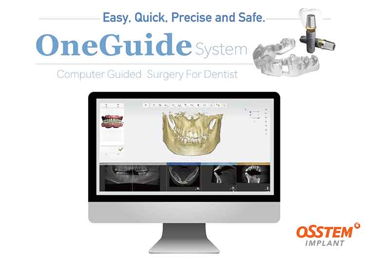 ワンガイドシステムとは