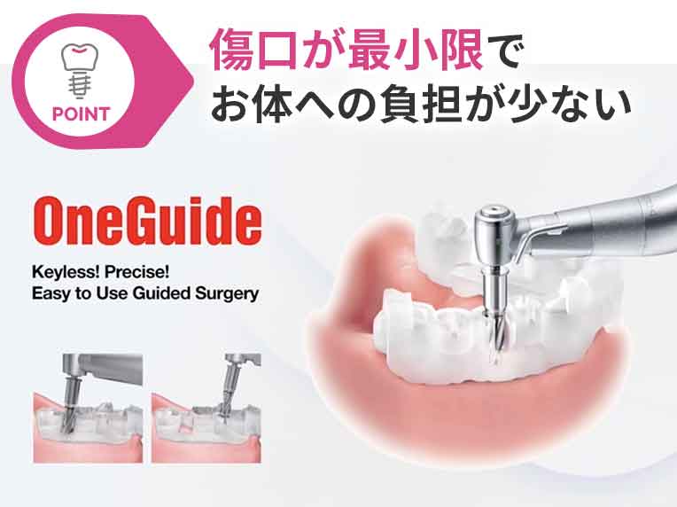 傷口が最小限でお体への負担が少ない