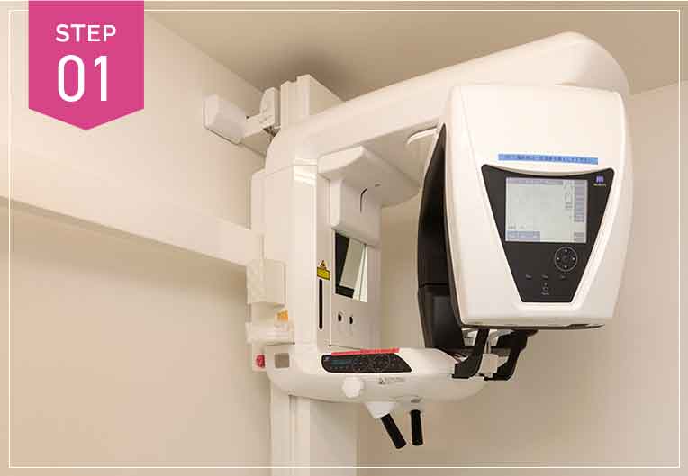 CTスキャンを撮影