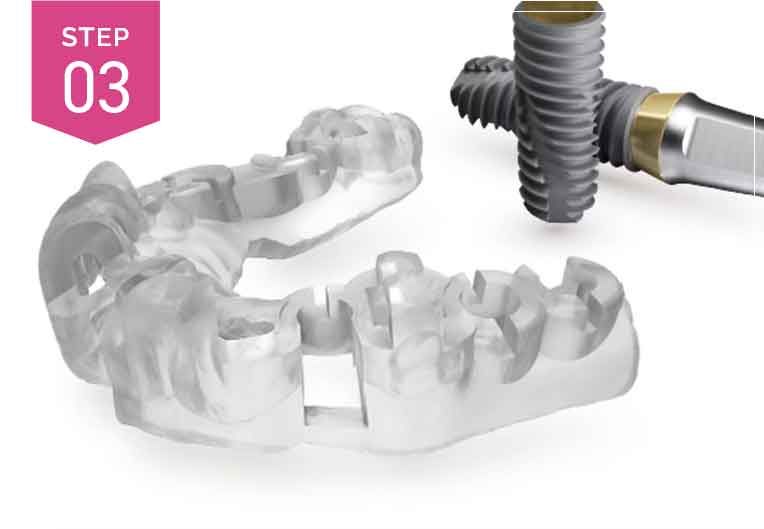 One Guideテンプレートの作製