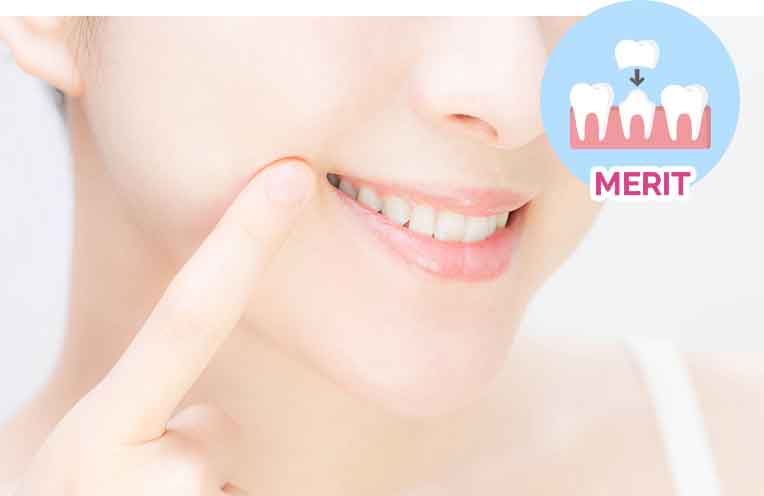 天然歯と見分けのつかない美しい仕上がり