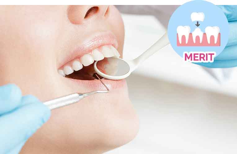 歯茎を黒く変色させない