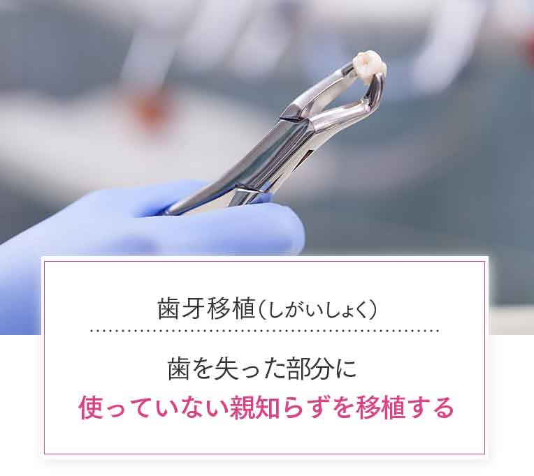 歯牙移植(しがいしょく)