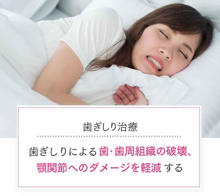 歯ぎしり治療