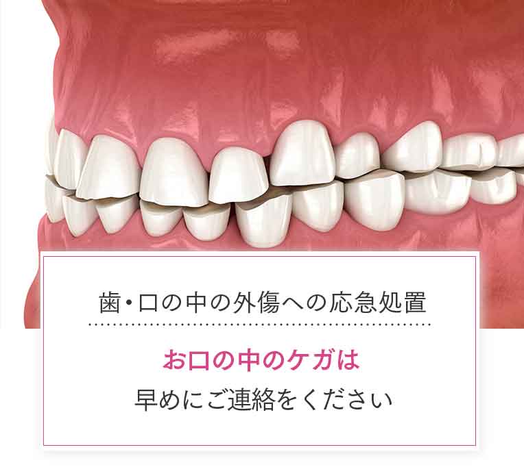 歯・口の中の外傷への応急処置