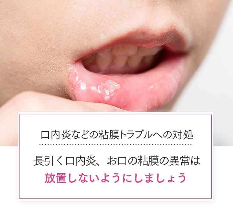 口内炎などの粘膜トラブルへの対処