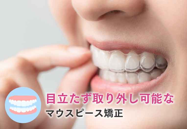 インビザライン(マウスピース矯正)