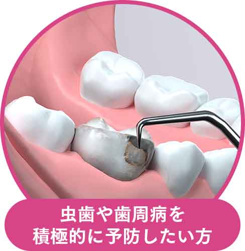 虫歯や歯周病を積極的に予防したい方