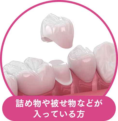 詰め物や被せ物などが入っている方
