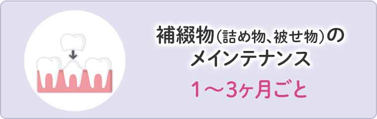 補綴物(詰め物、被せ物)のメインテナンス